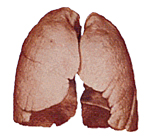 健康な人の肺